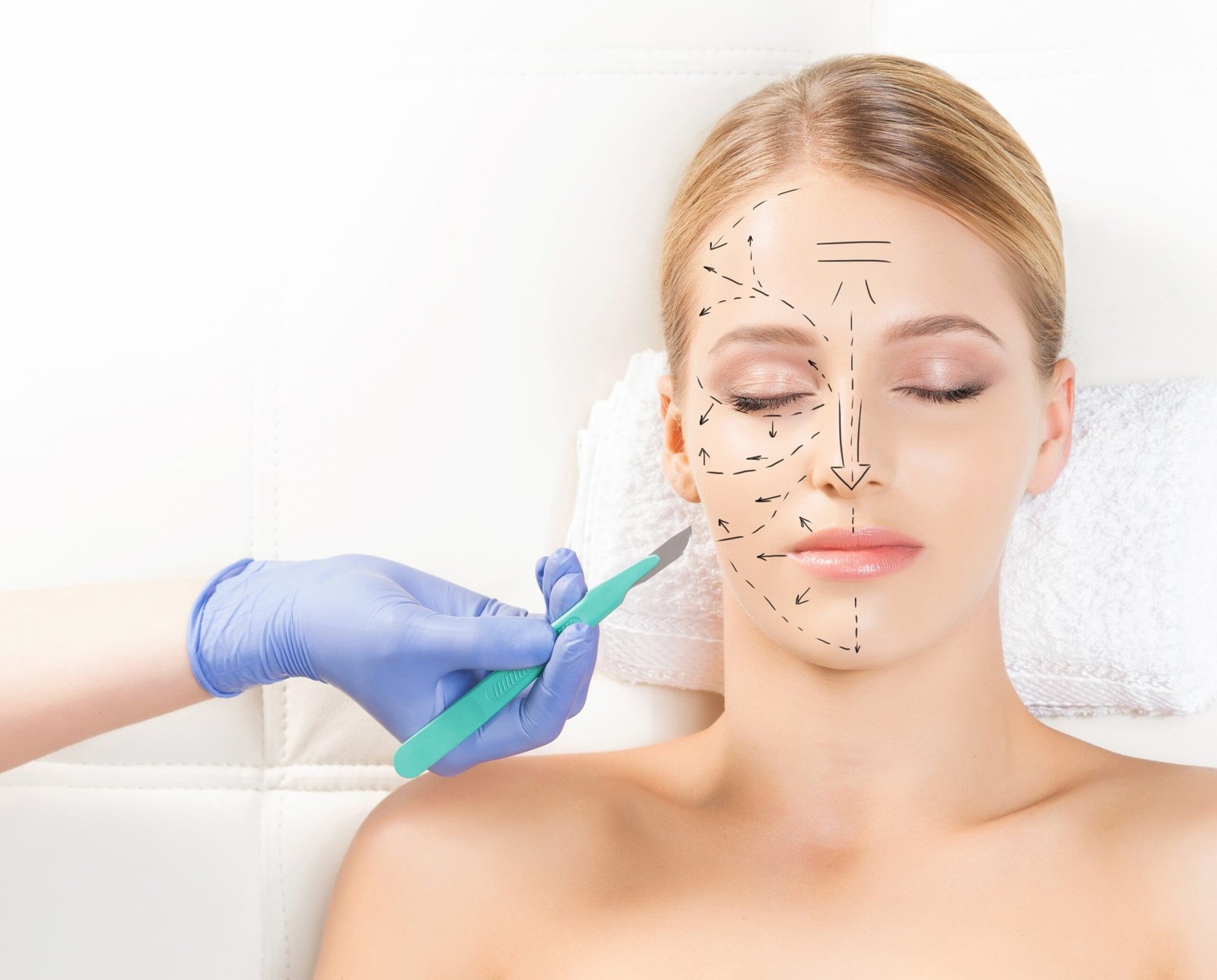 About Laser Hair Removal